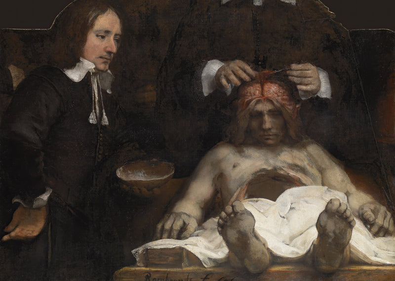 De anatomische les van Dr. Jan Deyman, Rembrandt van Rijn, kunstdruk van willem.